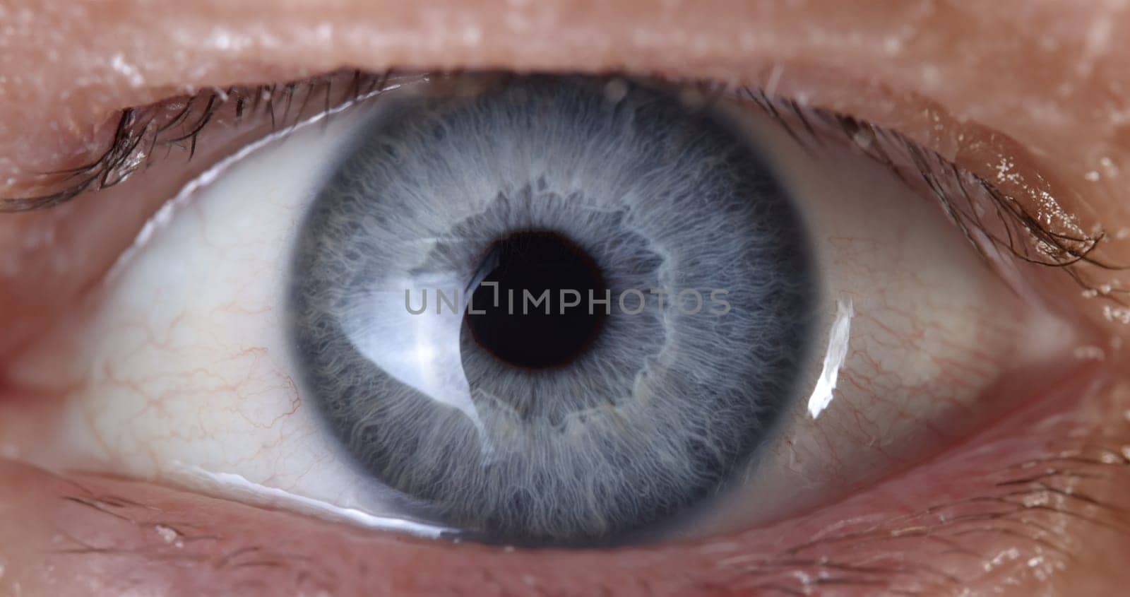 Blue eye close up. Production of colored contact lenses. Laser vision correction.