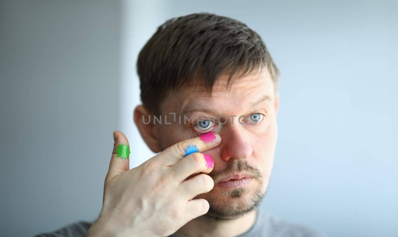Man scratches his face with a dirty hand near his eye portrait. Virus infection concept