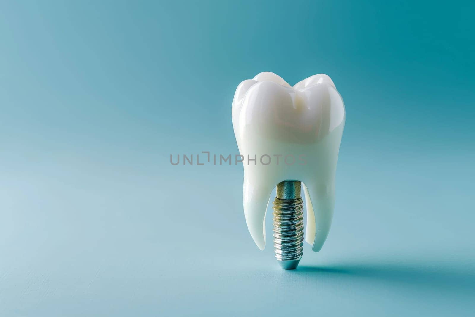 Dental Implant Procedure Implant Supported Teeth. Generative AI by matamnad