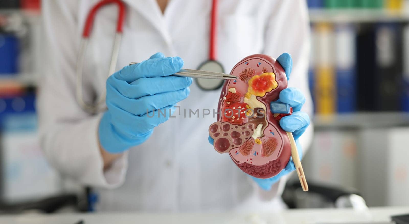 Urology and treatment of kidney diseases. Doctor performing a kidney examination on a female patient with kidney disease