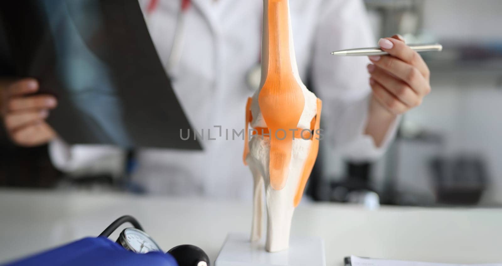 Doctor shows anatomy of knee joint and x-ray. Arthrosis of knee joint or gonarthrosis concept