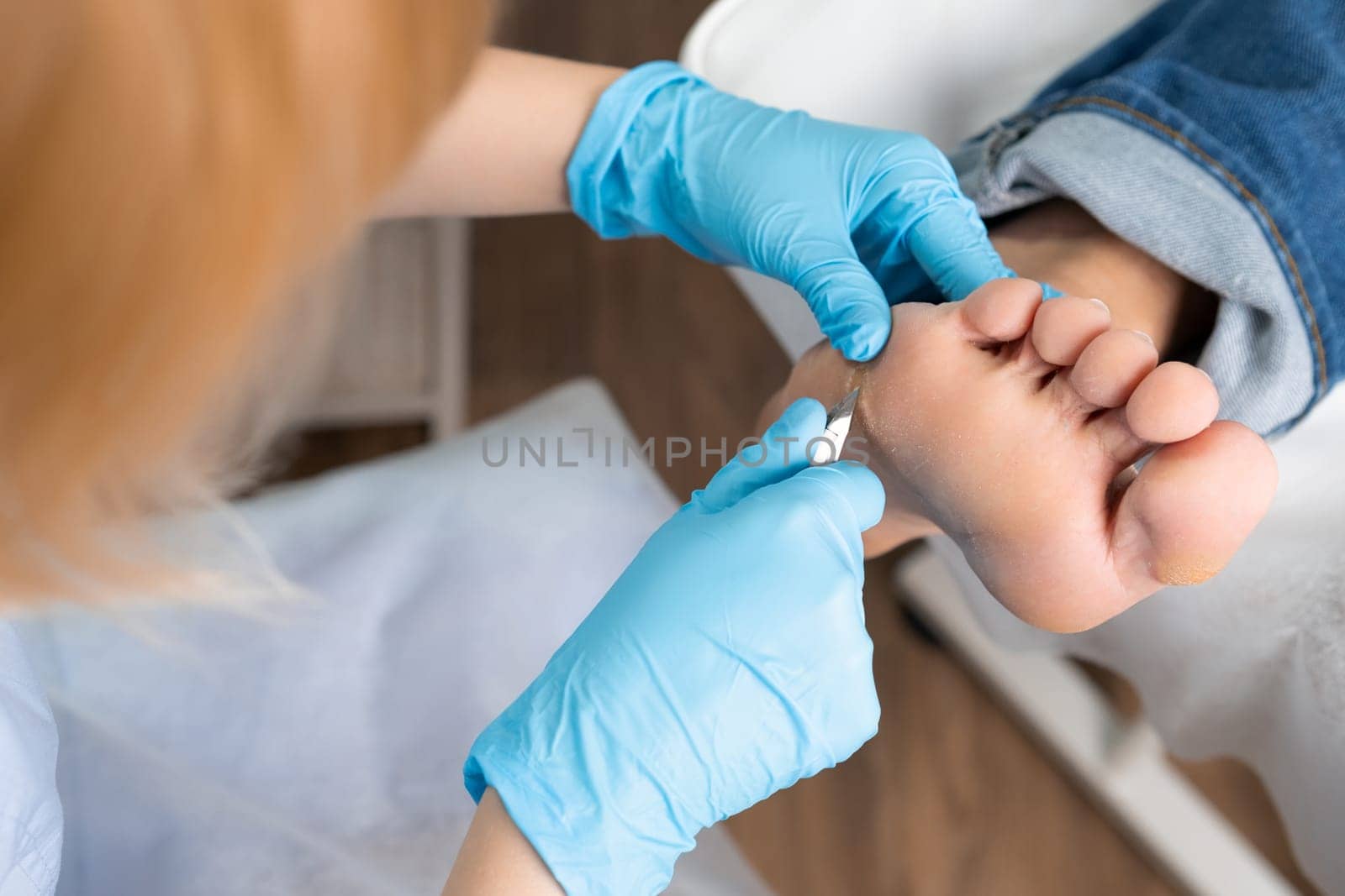 A podiatrist using clippers removes a callus from a womans foot at the medical center by vladimka