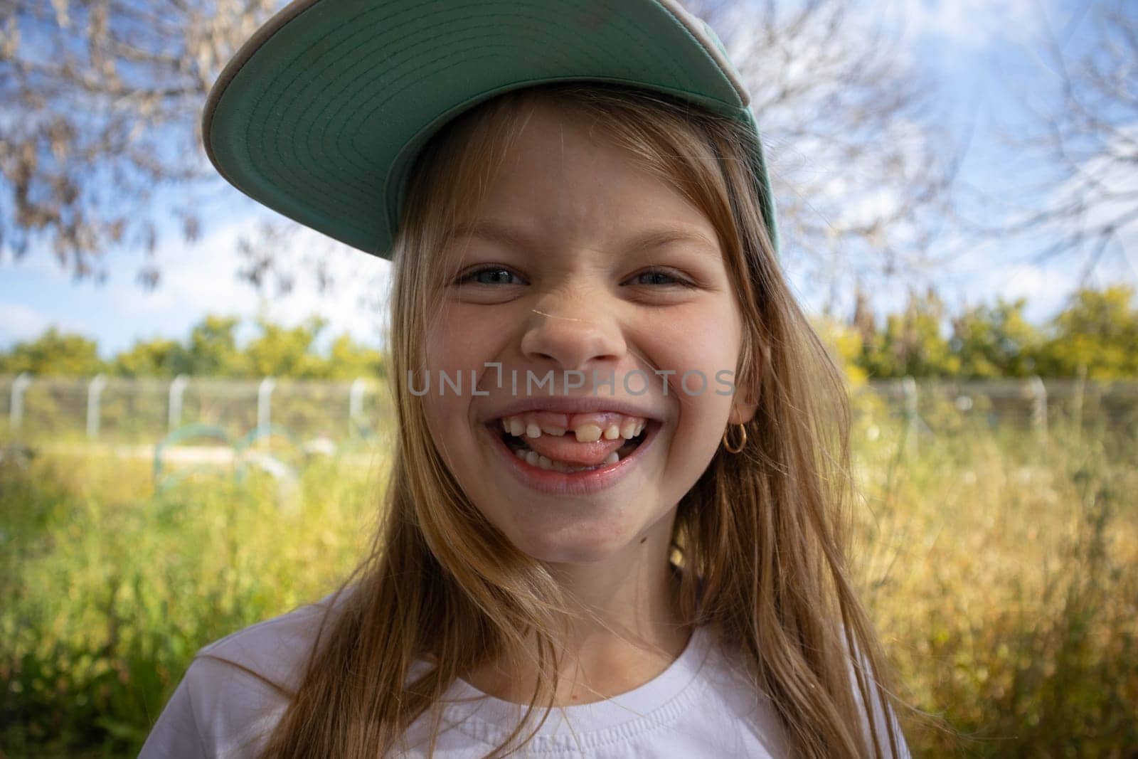 The little girl smiles. Permanent teeth appeared. High quality photo