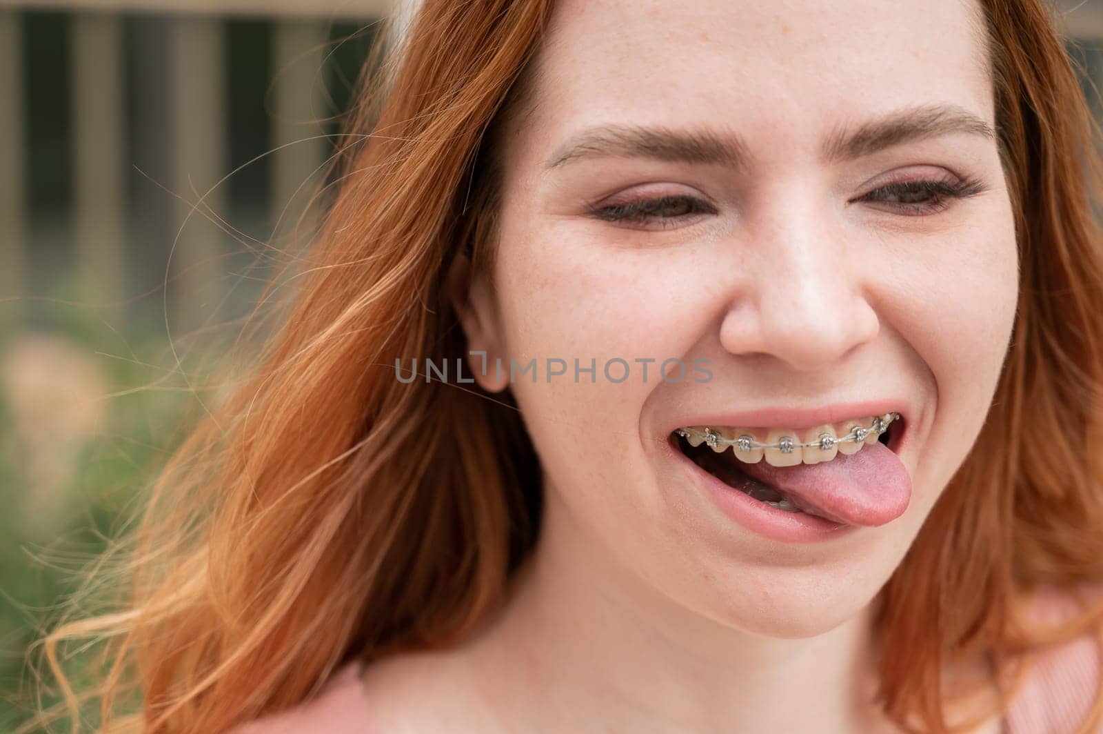 Young woman with braces on her teeth smiles and shows her tongue outdoors
