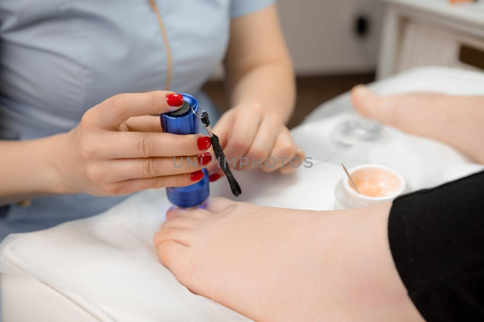 Podiatrist applies a titanium thread to a toenail and employs a UV lamp
