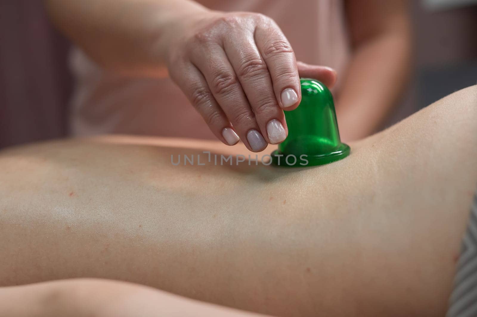 A woman undergoes an anti-cellulite massage procedure using a vacuum jar. Close-up of the lower back. by mrwed54