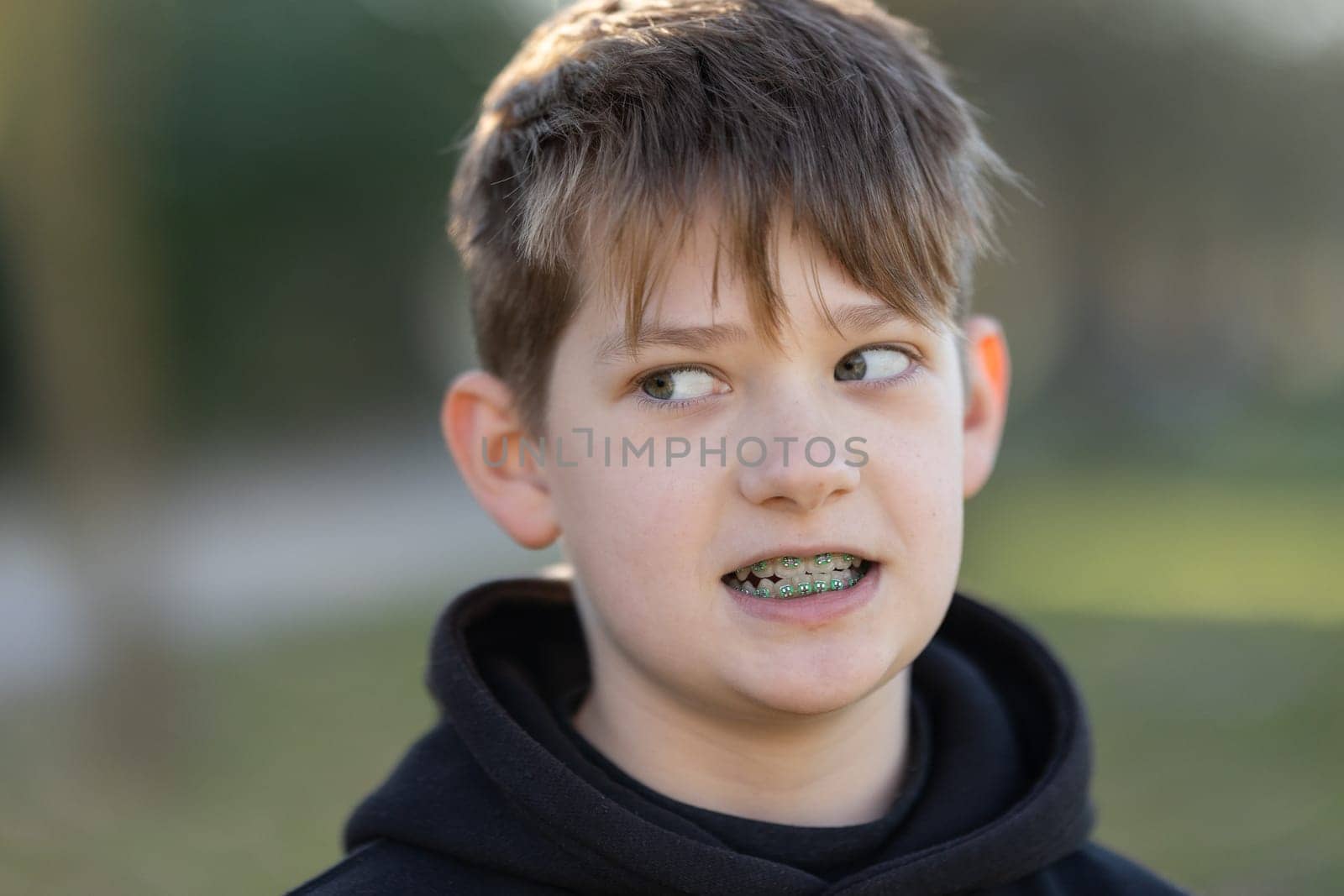 A boy with braces is wearing a black hoodie by Studia72