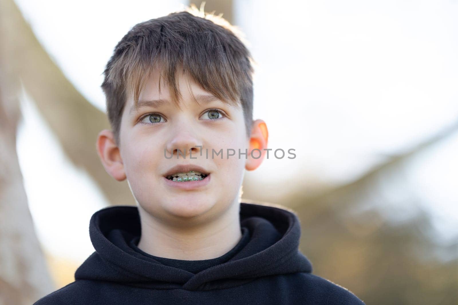 A boy with braces is smiling at the camera by Studia72