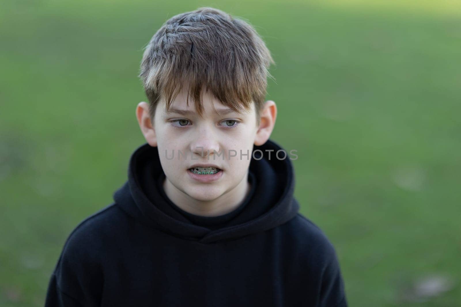 A boy with braces and a black hoodie is looking at the camera. Concept of discomfort and unease, as the boy's facial expression suggests that he is not happy or at ease