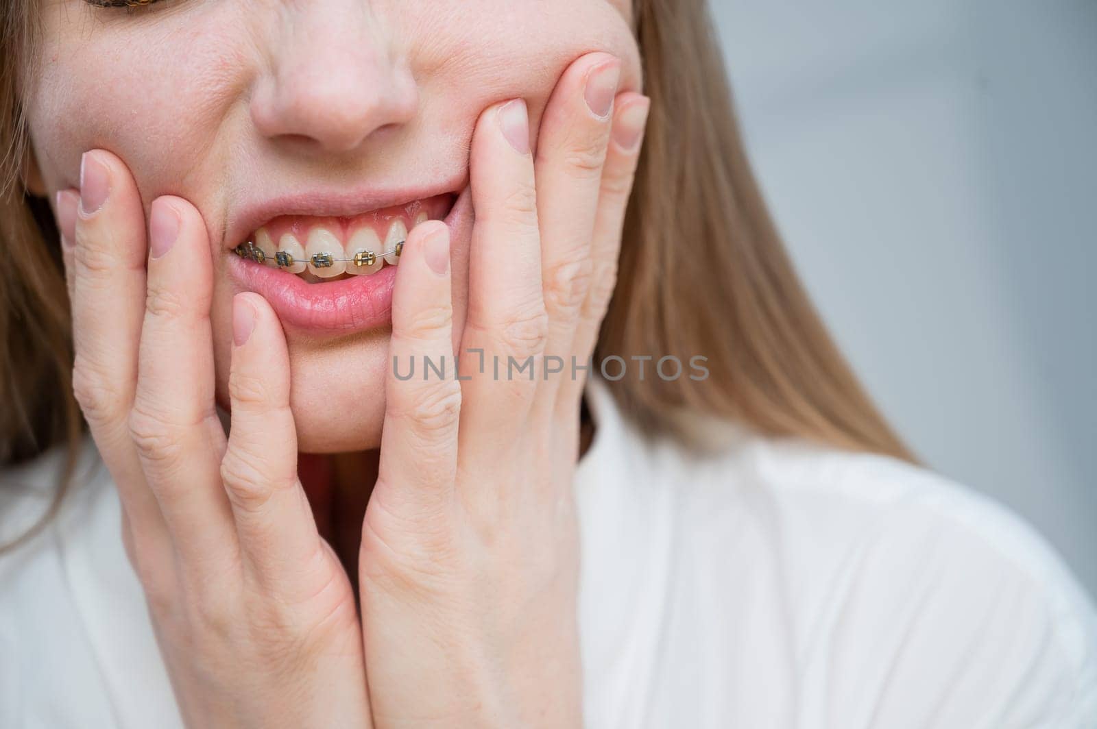 Close-up portrait of a red-haired girl suffering from pain due to braces. Young woman corrects bite with orthodontic appliance. by mrwed54