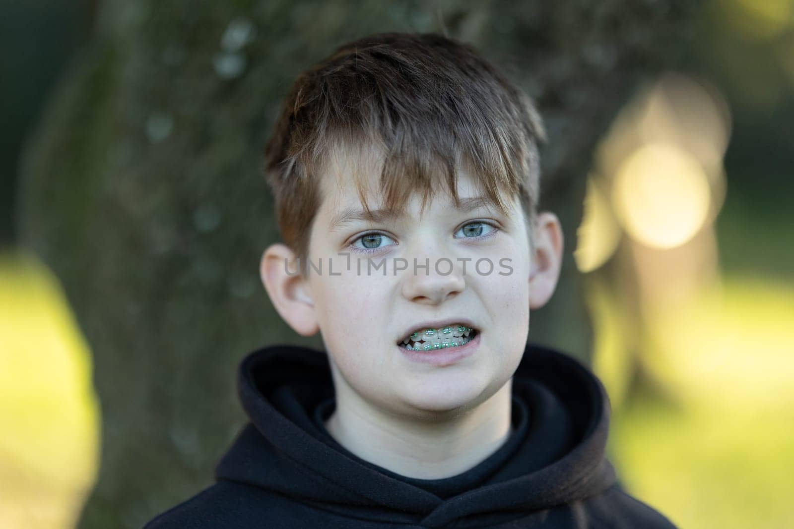 A boy with braces is standing in front of a tree. He has a serious expression on his face