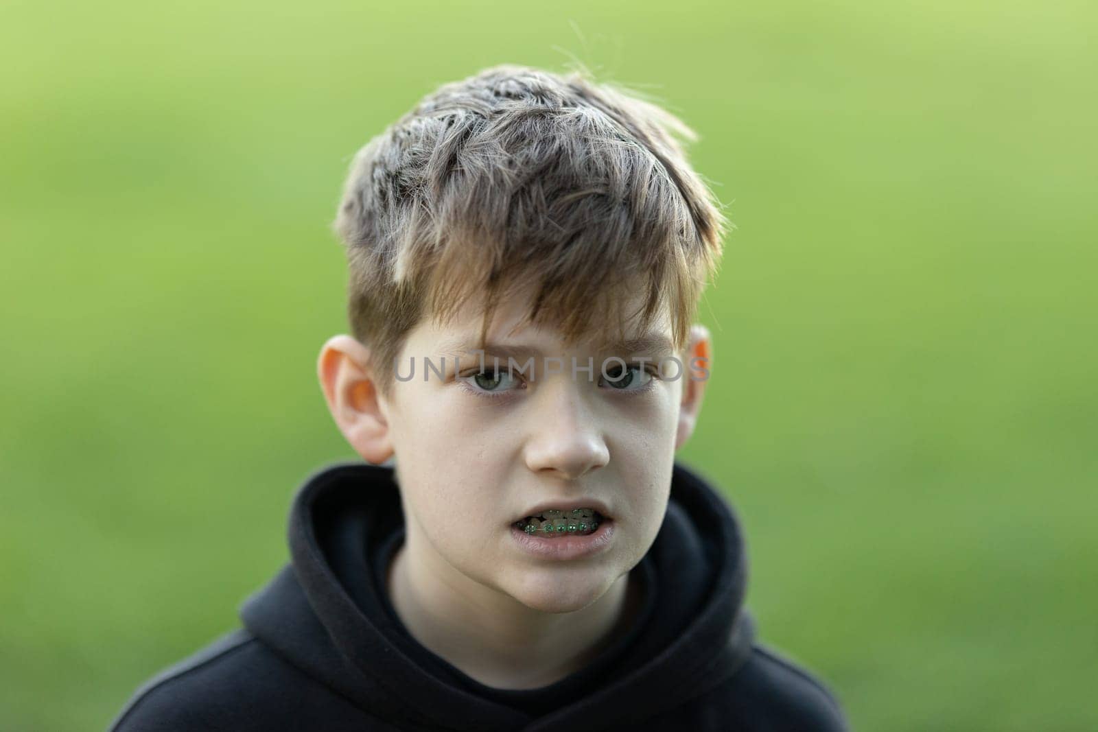 A boy with braces and a black hoodie is looking at the camera. The boy's mouth is open, and he has a serious expression on his face