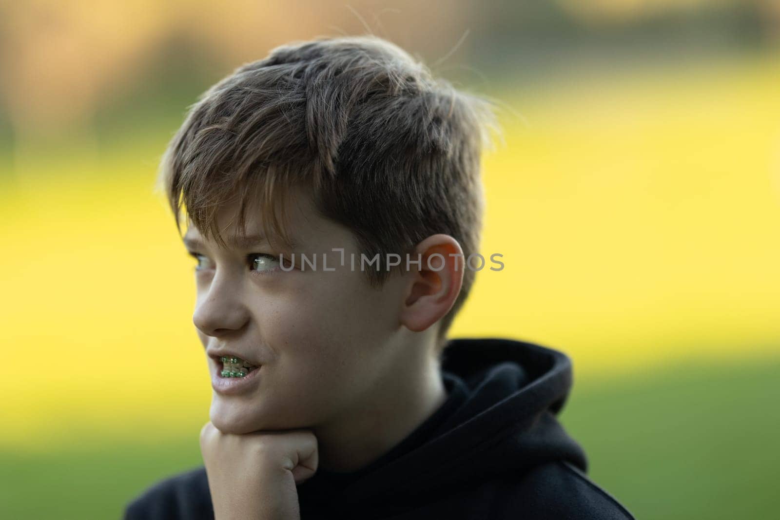 A boy with braces is looking at the camera. He is wearing a black hoodie and has a black and white striped shirt on