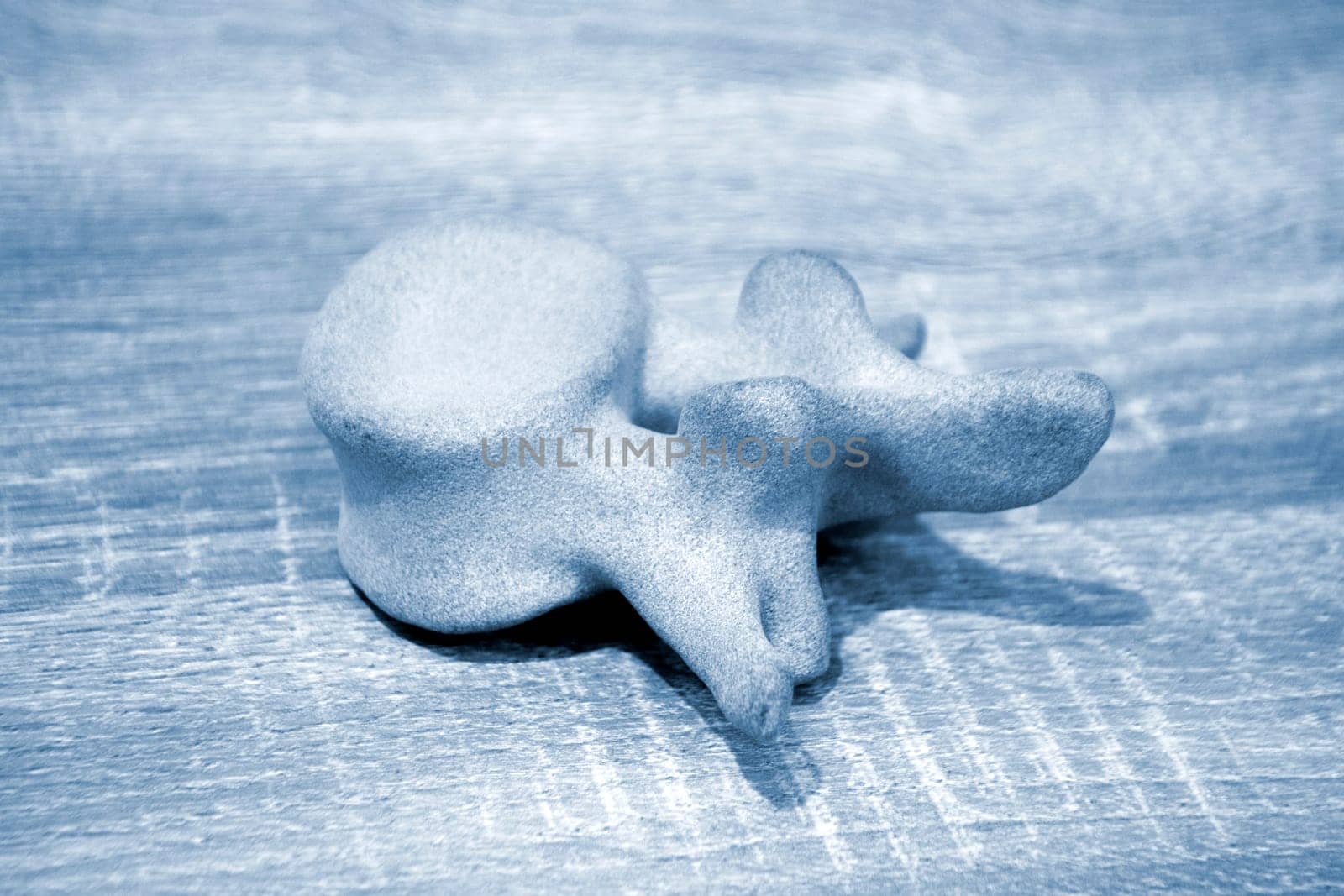 Prototype model of human vertebra 3D printed from polyamide powder. Technology Multi Jet Fusion MJF. Three-dimensional model printed on 3D printer from plastic. Additive progressive powder technology