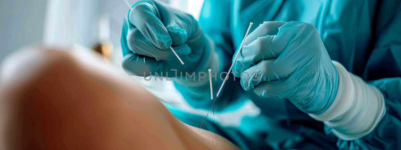 doctor's hands knee acupuncture procedure. selective focus. by yanadjana