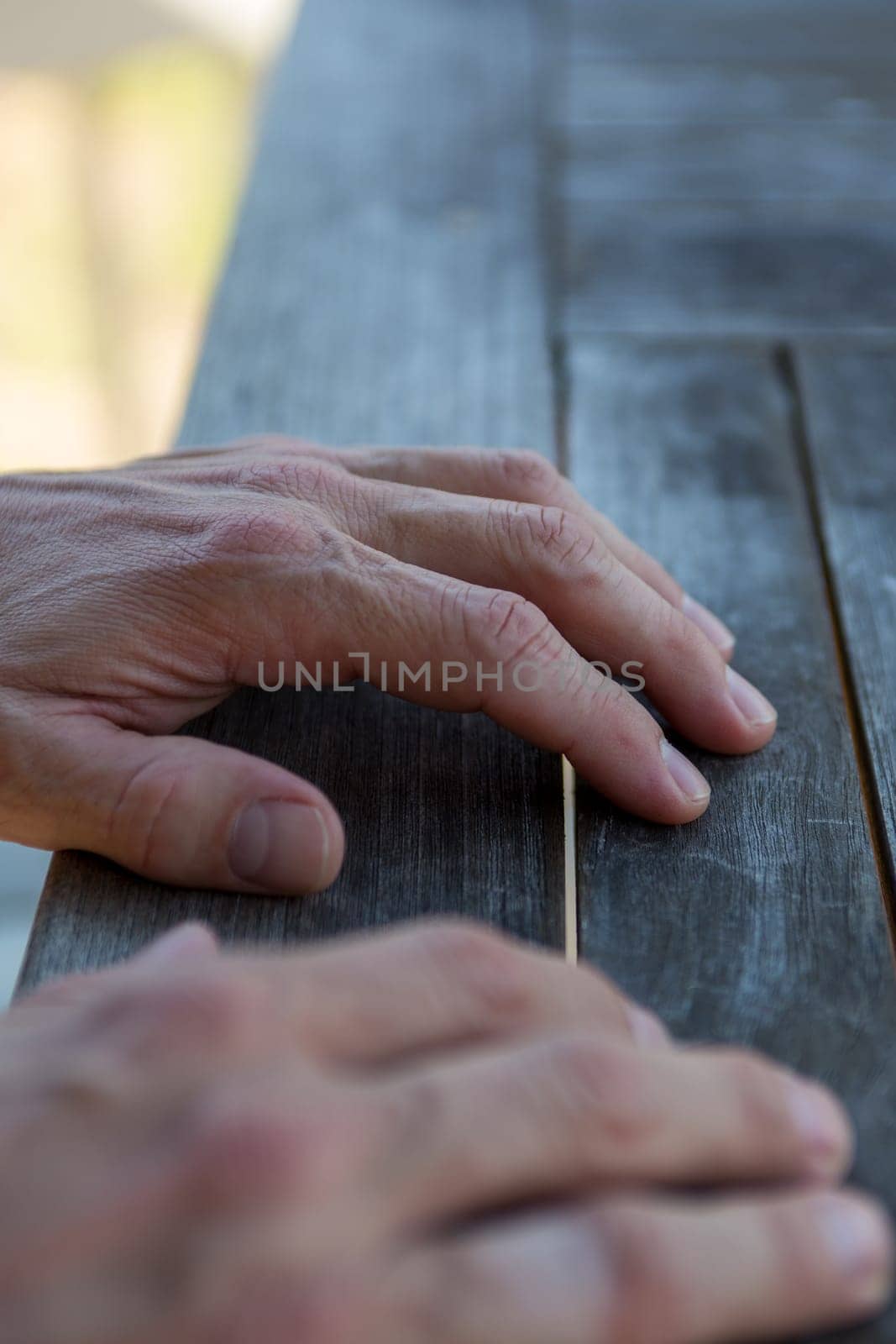 Mans hands on the table waiting to be taken cared of