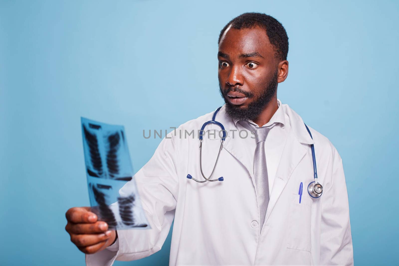 Shocked doctor wearing white lab coat and stethoscope staring at a chest x-ray image that shows alarming test results. Medical professional holding a diagnosis of pulmonary radiography.