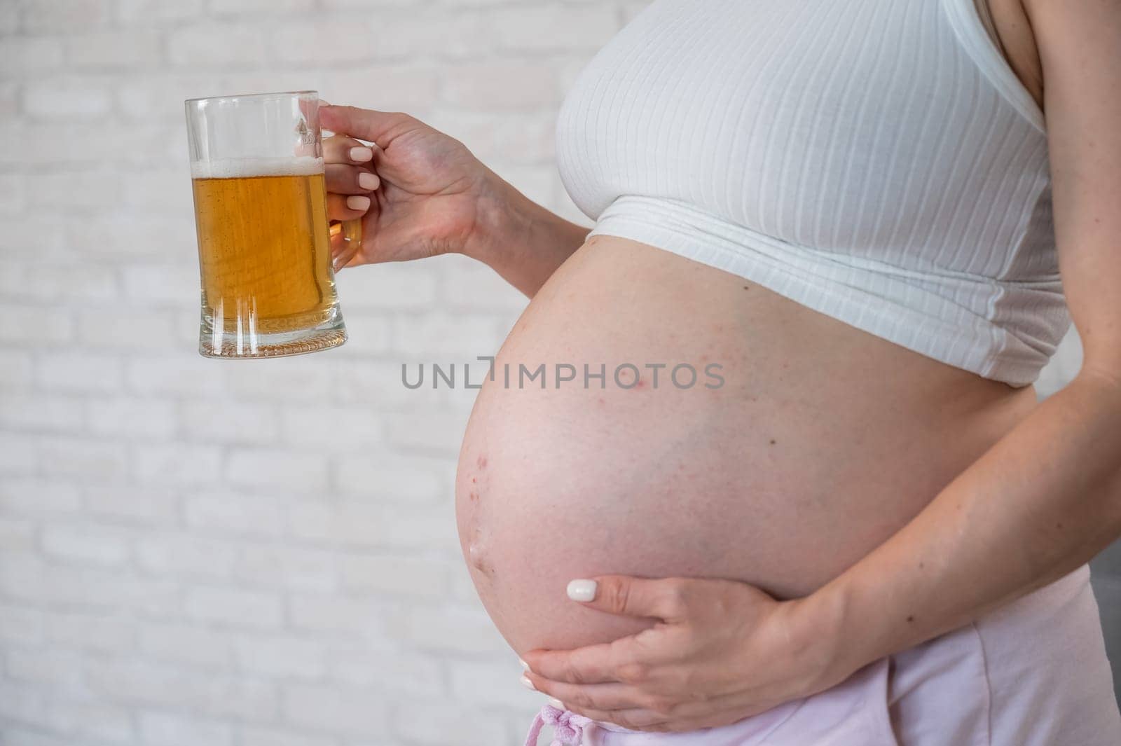 Faceless pregnant woman with rash on stomach holding glass of beer. by mrwed54