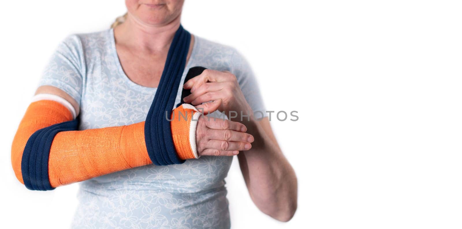 middle aged woman with broken arm in cast hangs her arm in a sling, modern treatment methods, on a neutral background by KaterinaDalemans