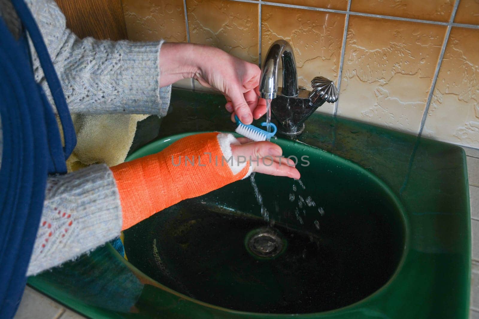 woman with a broken right arm in a cast washes her fingers free of a bandage under running water in the sink, maintaining hygiene, high quality photo