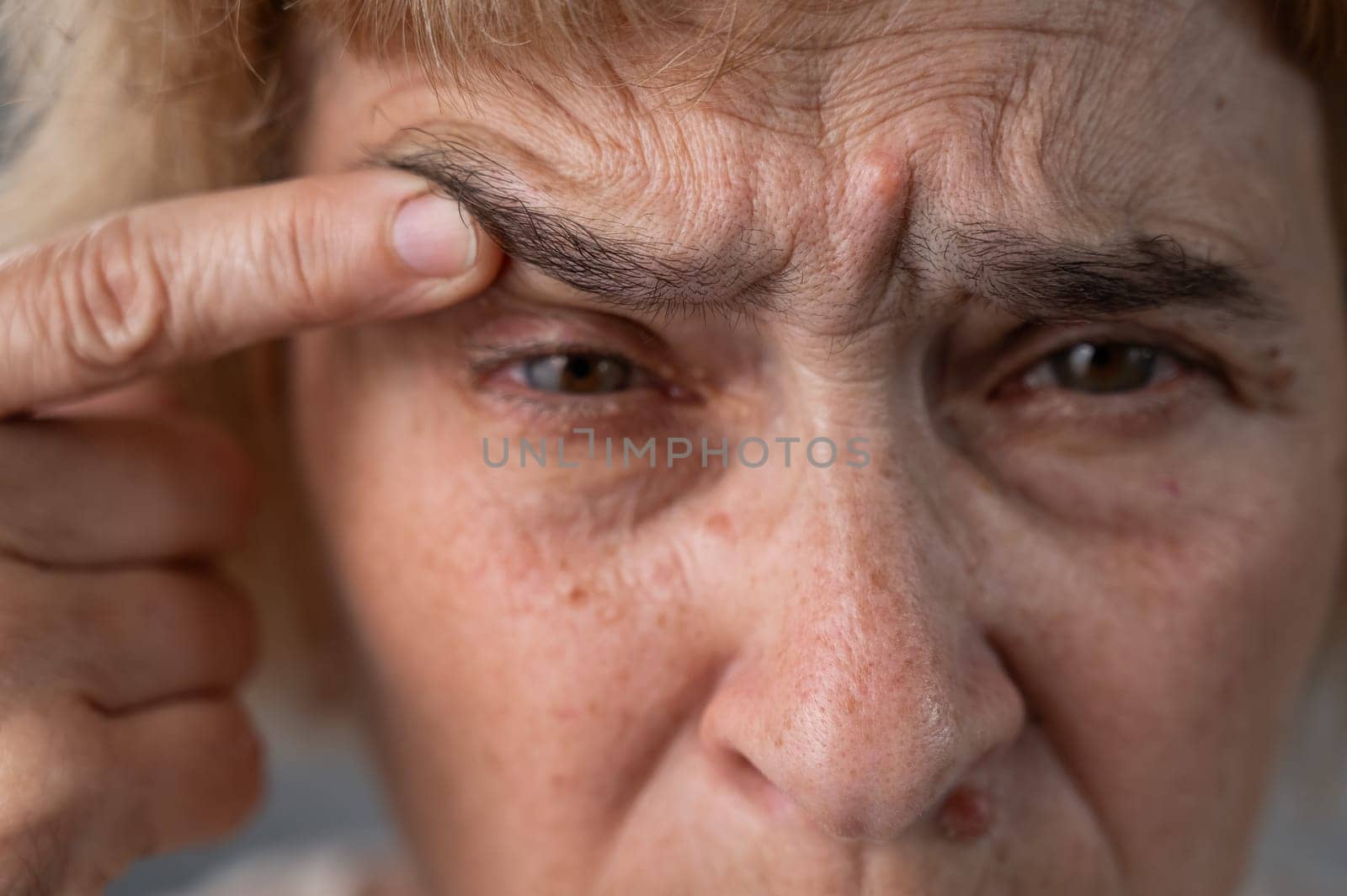 Close-up portrait of an old woman pointing at a wrinkle on her upper eyelid