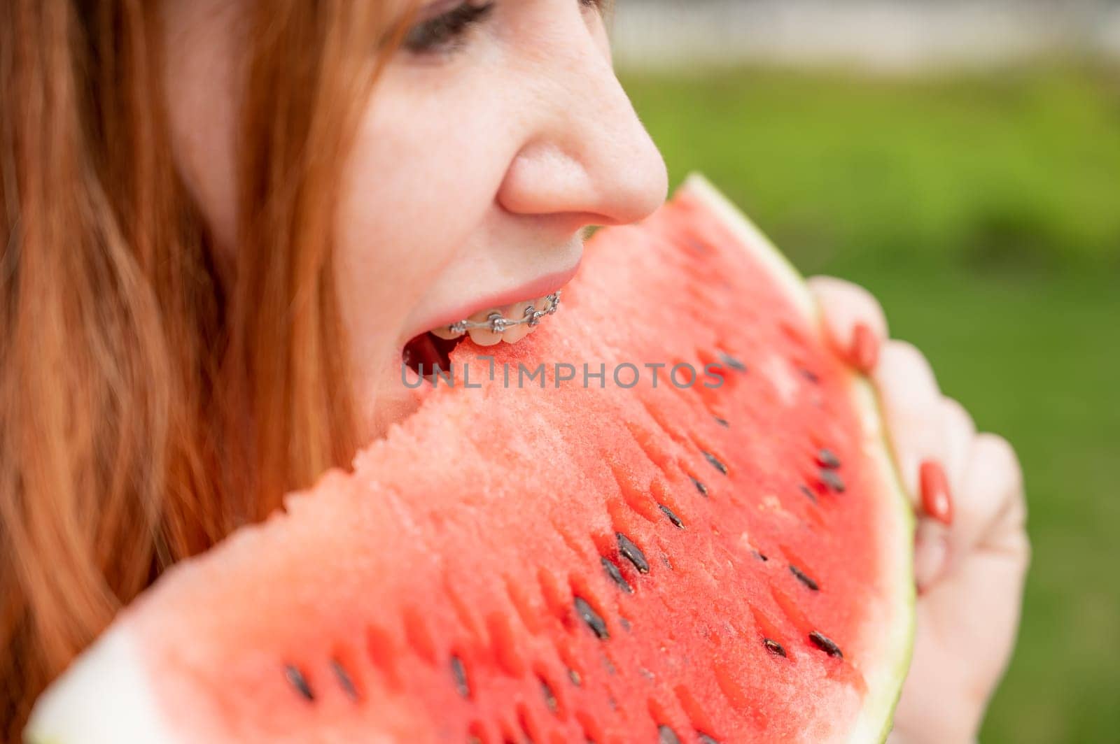Close-up portrait of red-haired young woman with braces eating watermelon outdoors by mrwed54