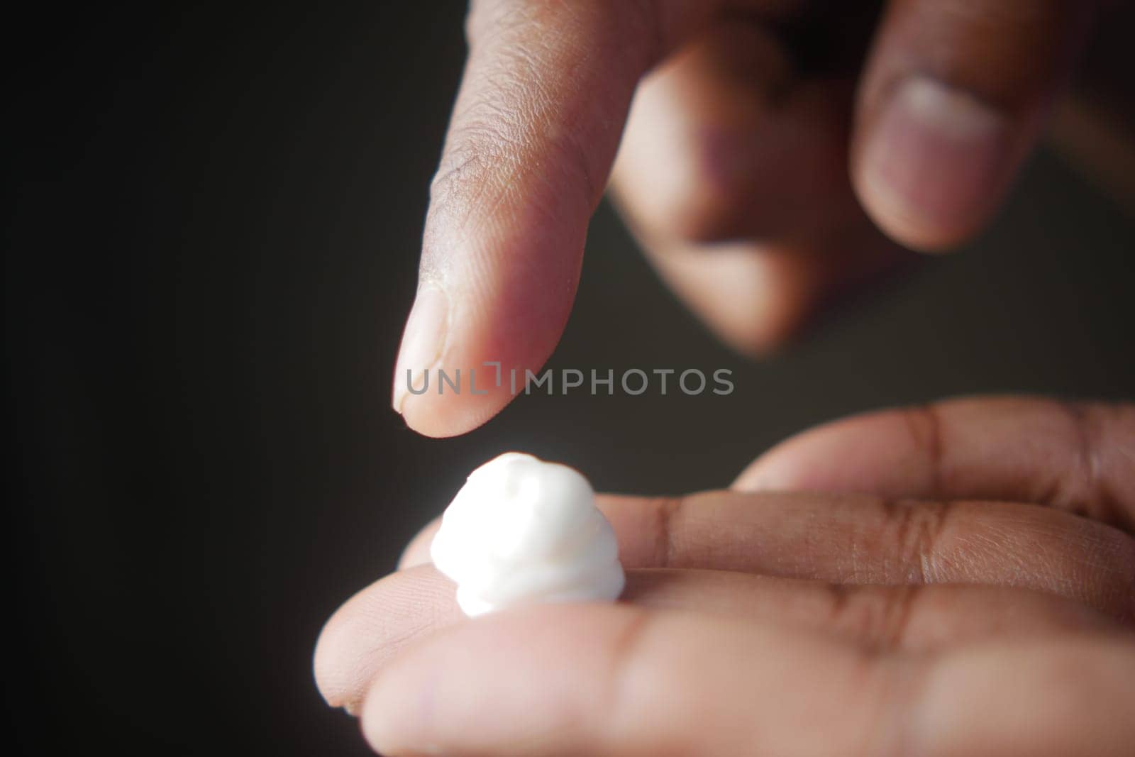 Man applying antibiotic cream close up by towfiq007