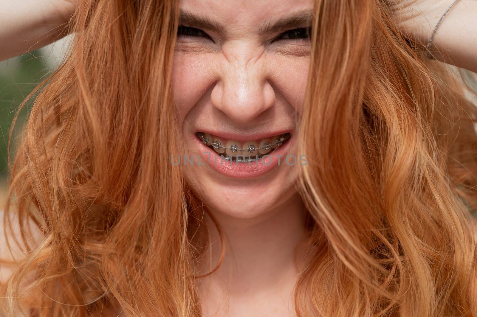 Close-up portrait of a young red-haired woman with braces on her teeth. Girl makes faces at the camera outdoors
