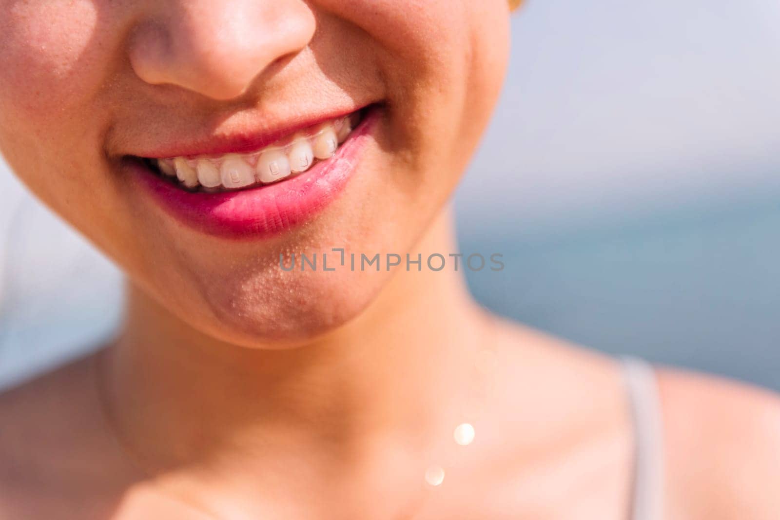 close up of the mouth of a beautiful woman with invisible braces smiling happy, dental health and beauty concept