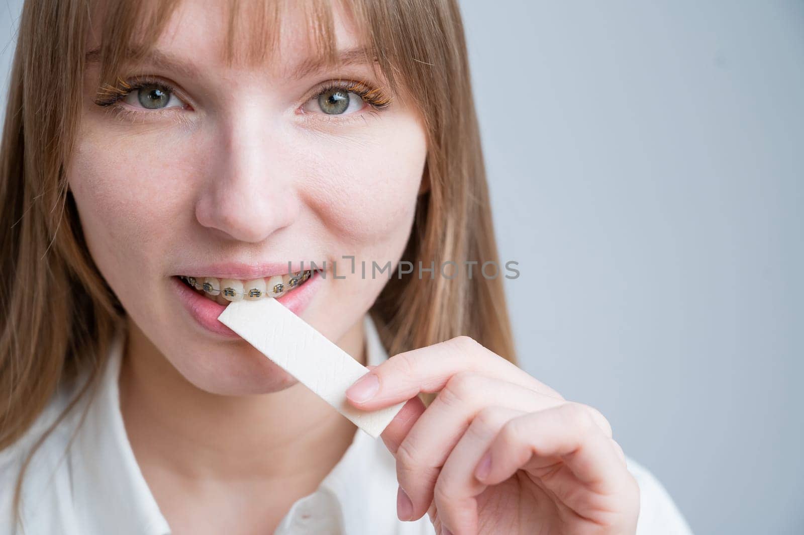 Young woman with metal braces on her teeth is chewing gum. Copy space