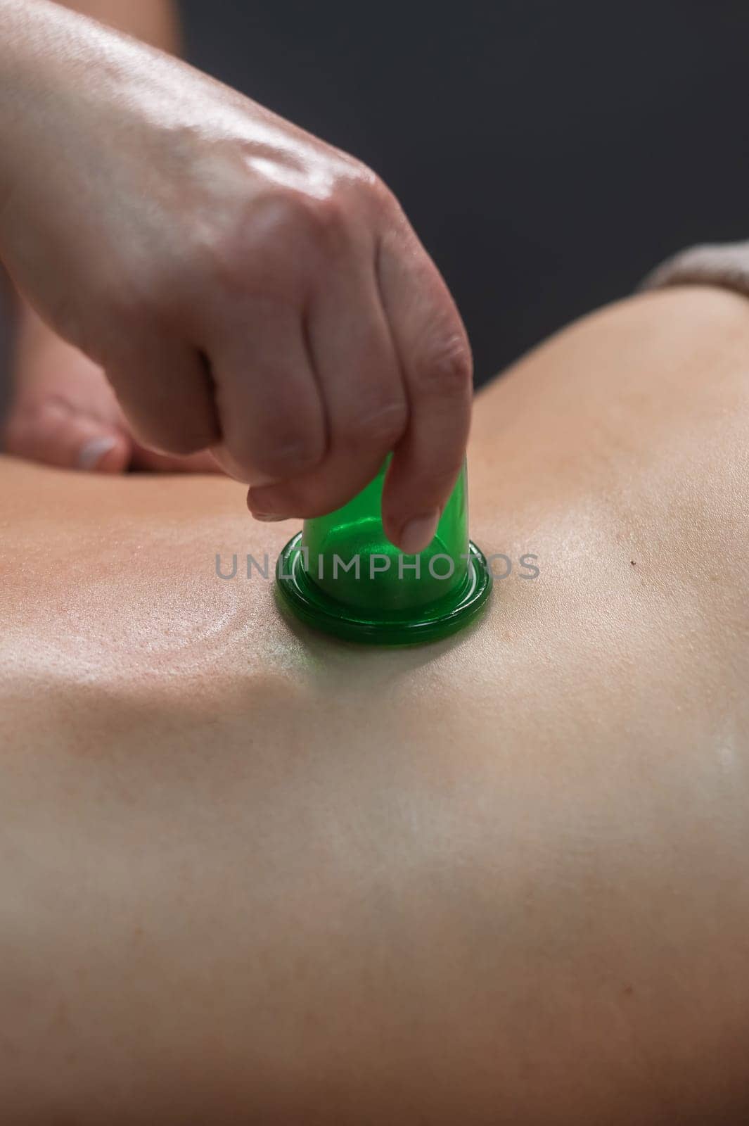 A woman undergoes an anti-cellulite massage procedure using a vacuum jar. Close-up of the lower back. Vertical photo. by mrwed54