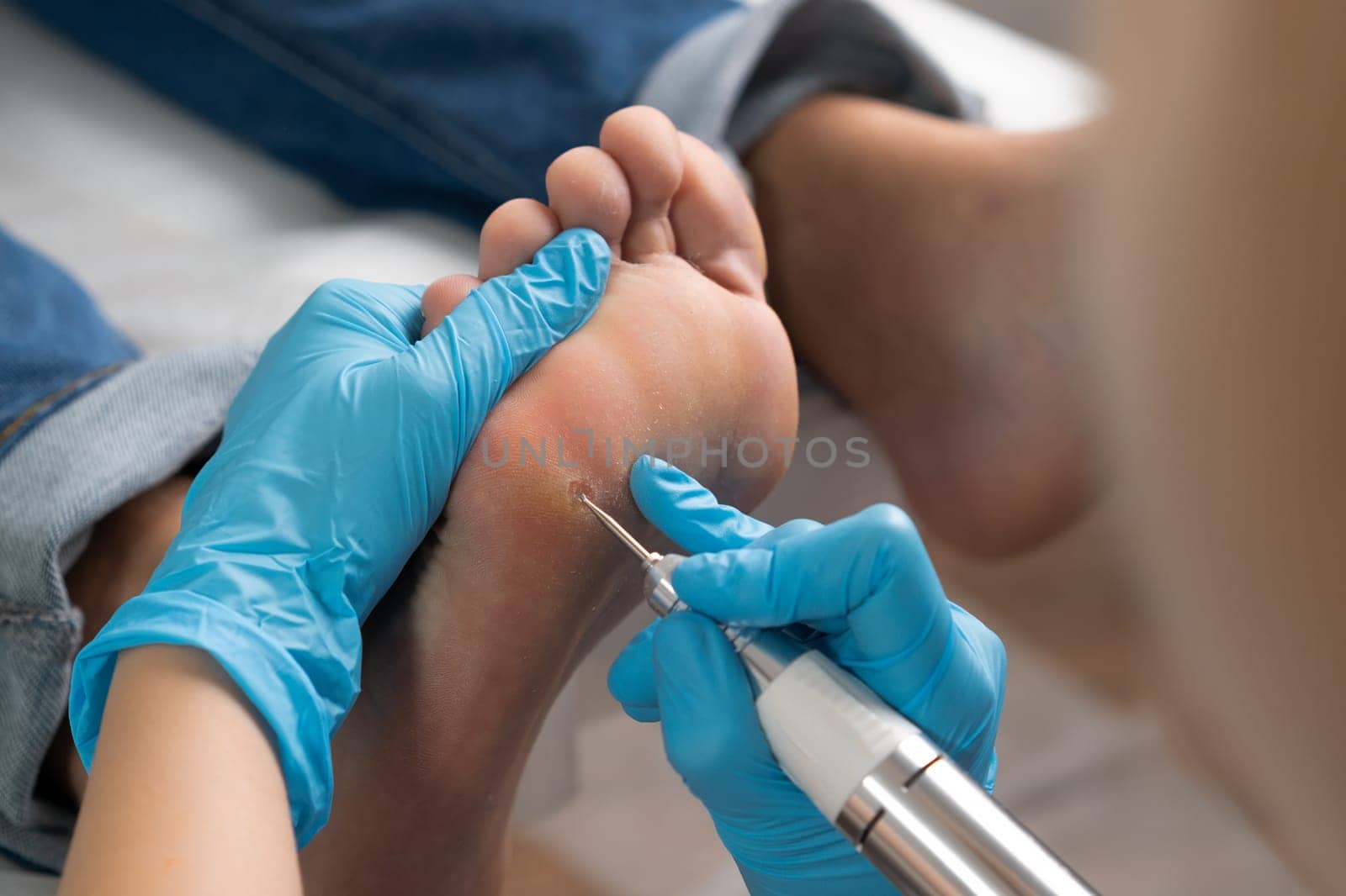 Close up removing a callus on a womans foot by electric drill by vladimka