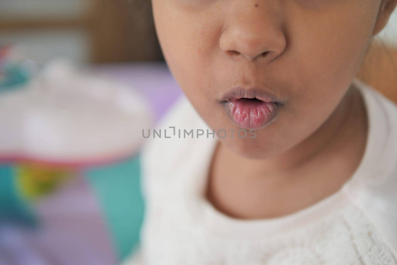 close up of dry lip of a child ,