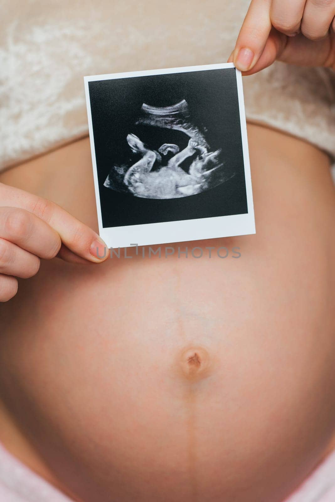 ultrasound picture in the hands of a pregnant girl on the background of the abdomen