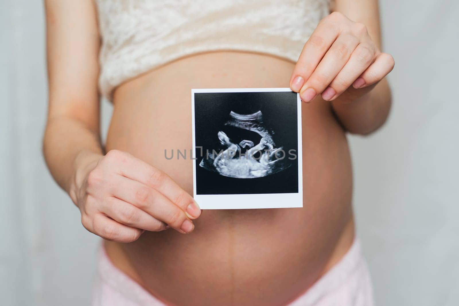 ultrasound picture in the hands of a pregnant girl on the background of the abdomen