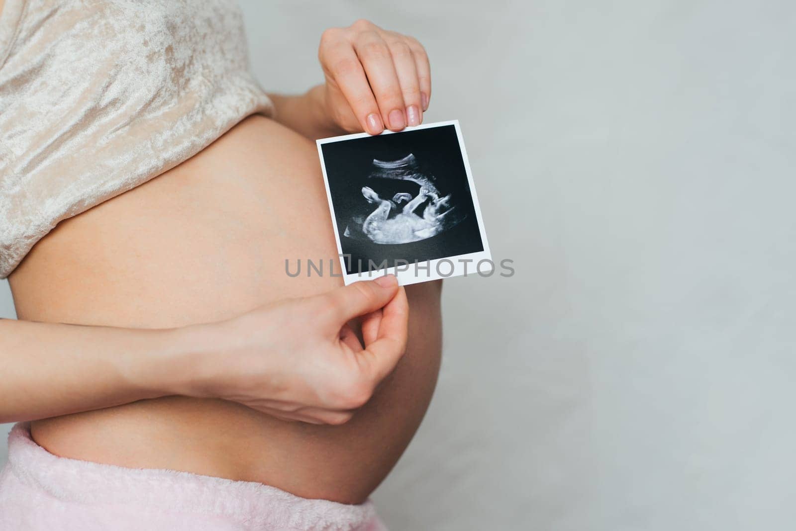 photo ultrasound in the hands of a pregnant young girl on a belly background