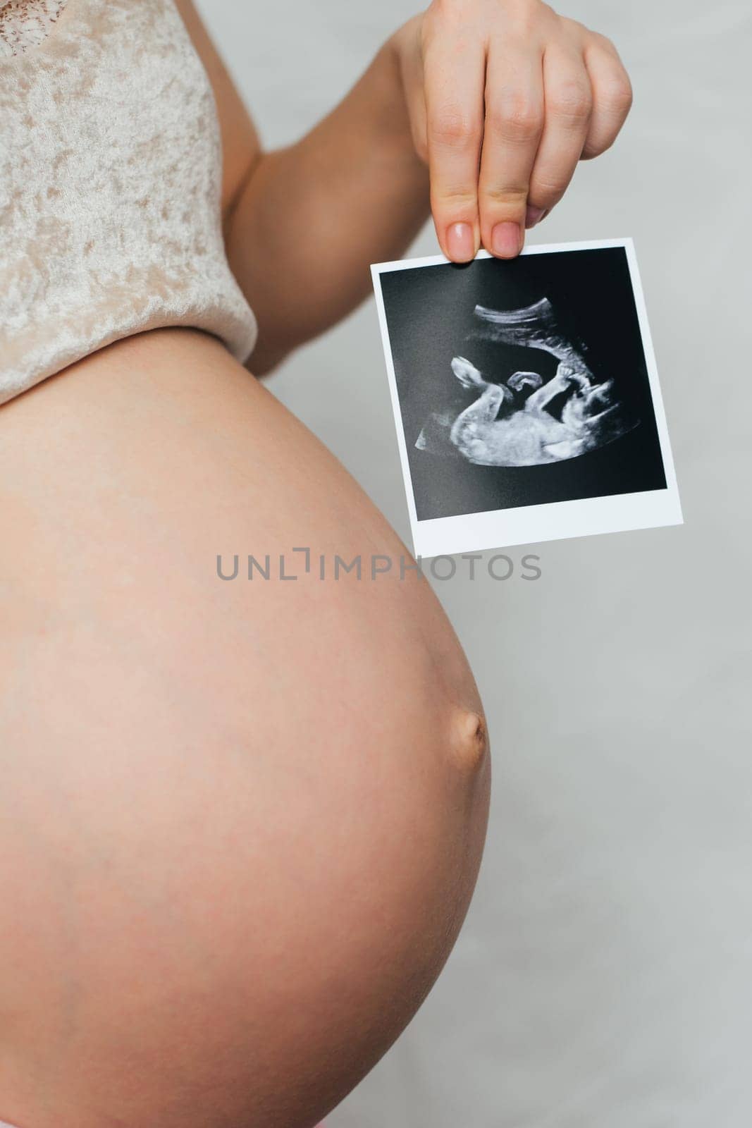 photo of a pregnant ultrasound in the hands of a pregnant girl on the background of the abdomen
