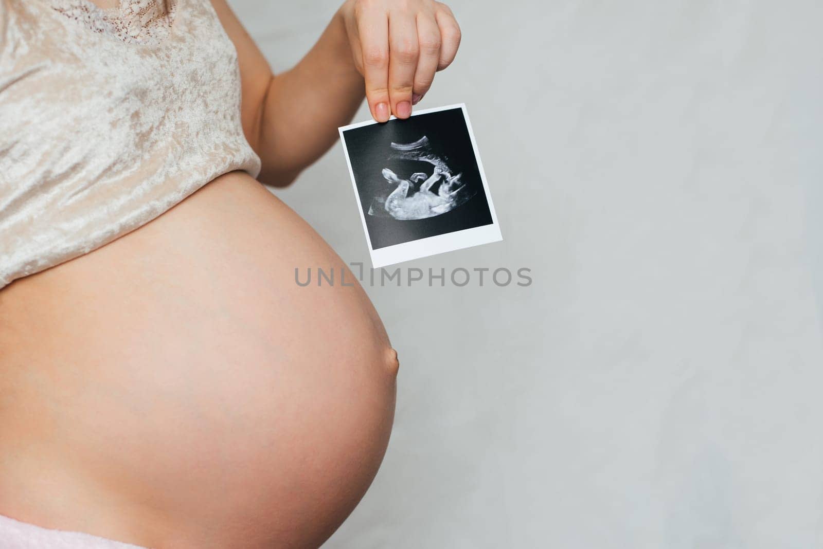 ultrasound picture in the hands of a pregnant girl on the background of the abdomen