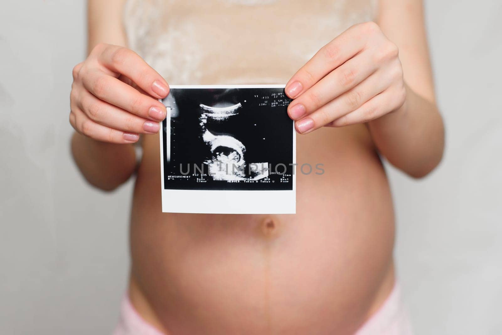 photo of a pregnant ultrasound in the hands of a pregnant girl on the background of the abdomen