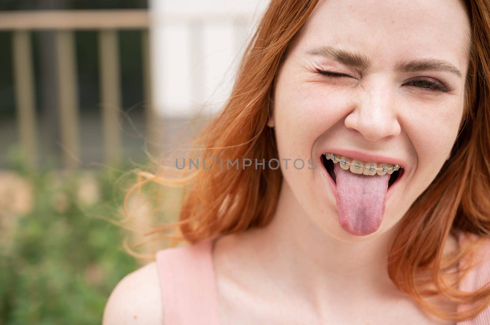 Young woman with braces on her teeth smiles and shows her tongue outdoors