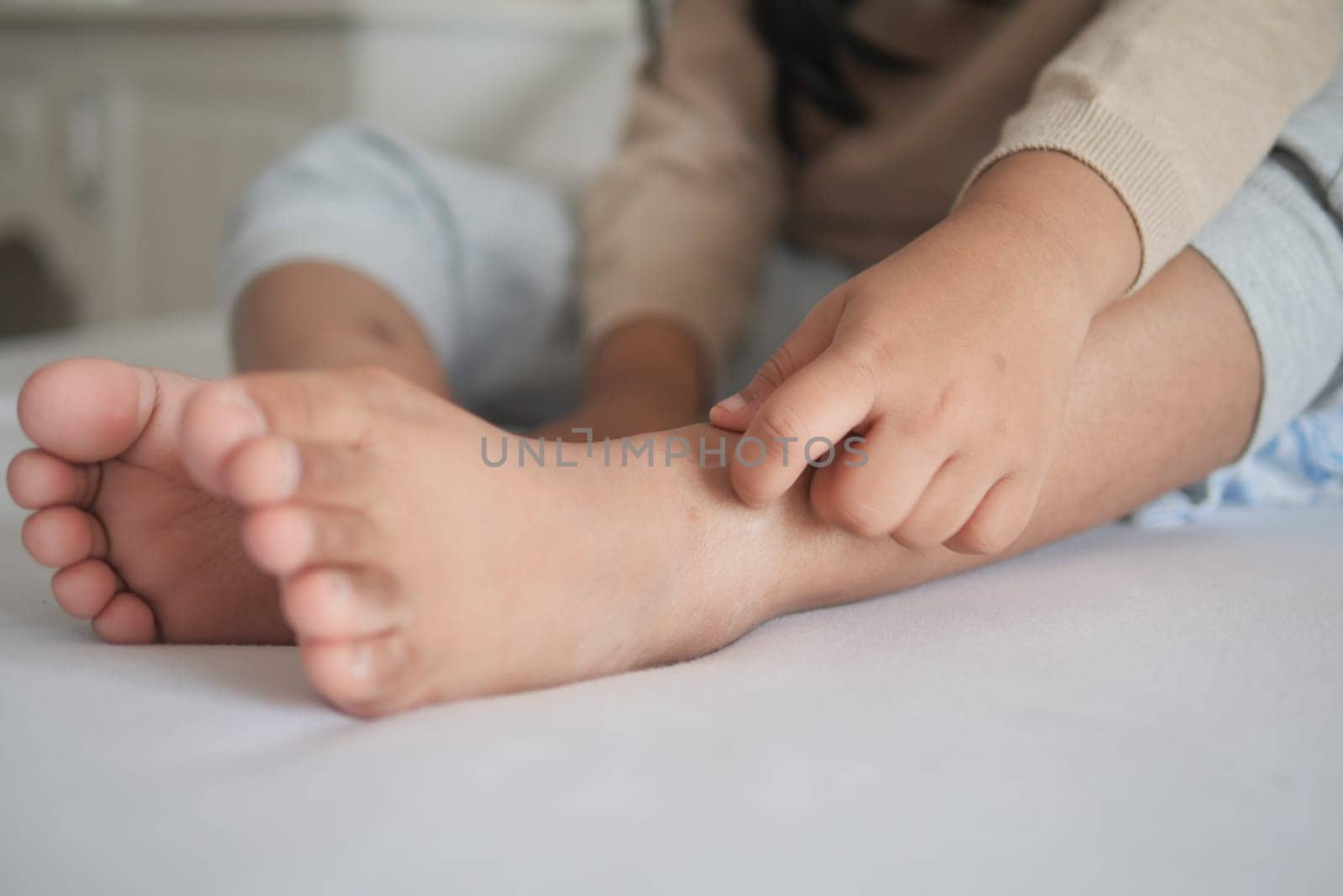 a kid suffering from itching skin on feet .