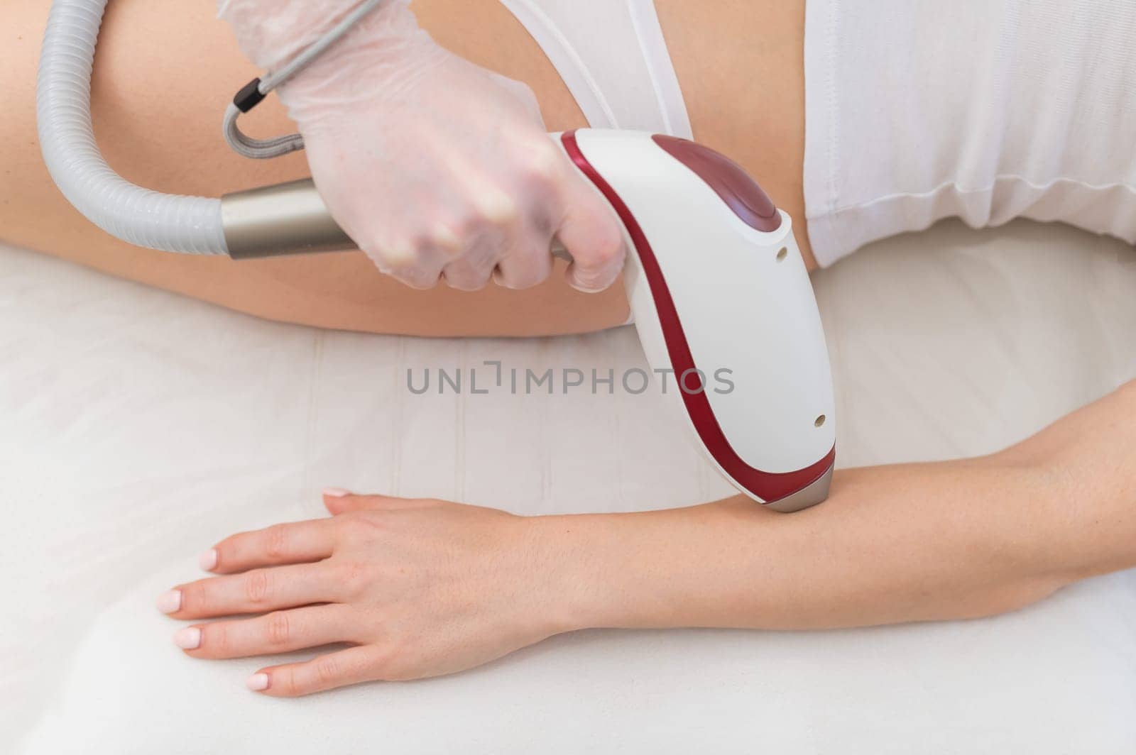 Woman on laser epilation procedure. Hardware removal of unwanted vegetation on hands.