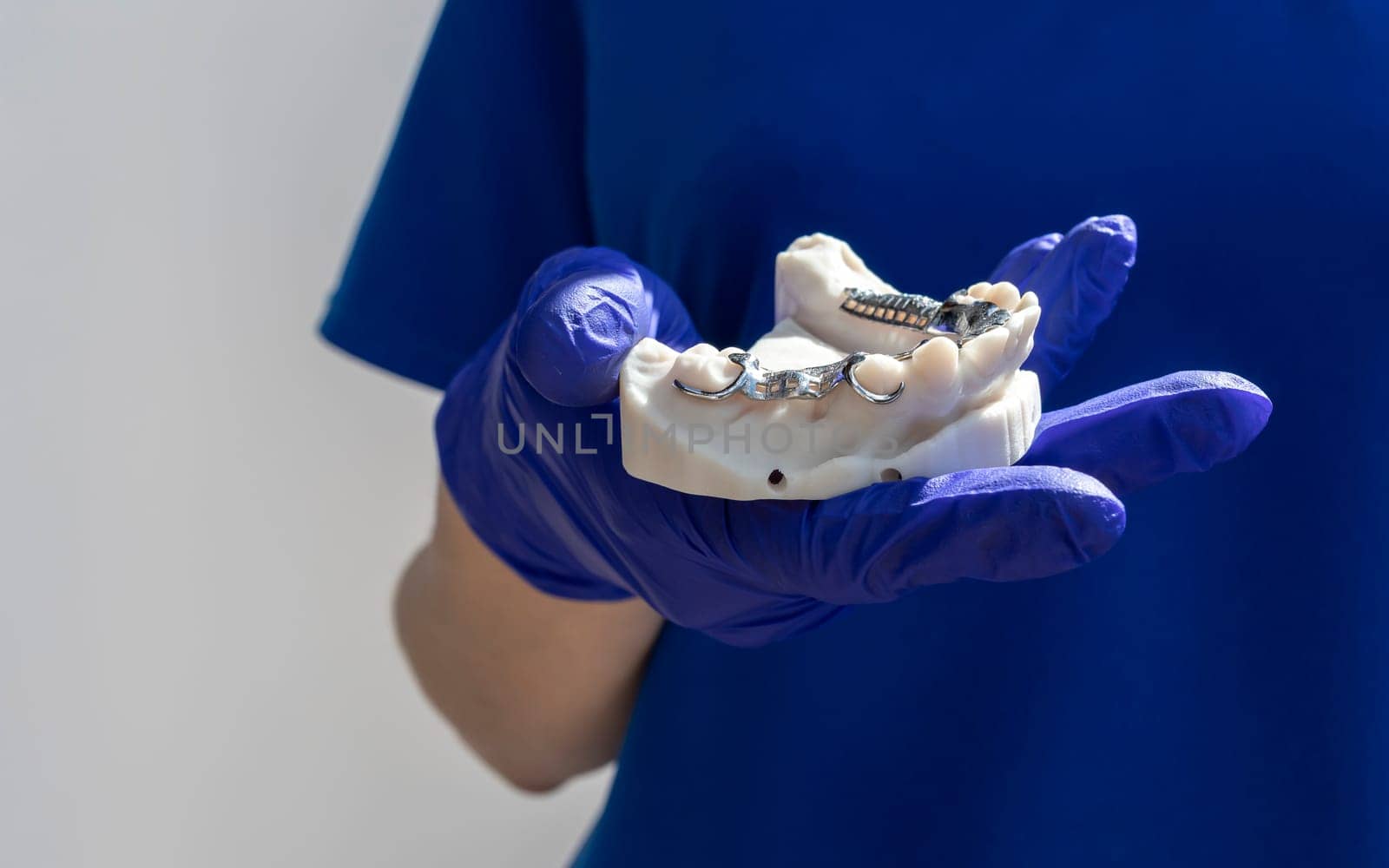 Cropped Doctor with Metal Frame Lower Partial Denture with Die Stone, Plaster Cast Molds Of Lower Jaws in Gloved Hand on White Background, Cobalt Chrome Dental Plate, 3D Printed Bridge. Horizontal.