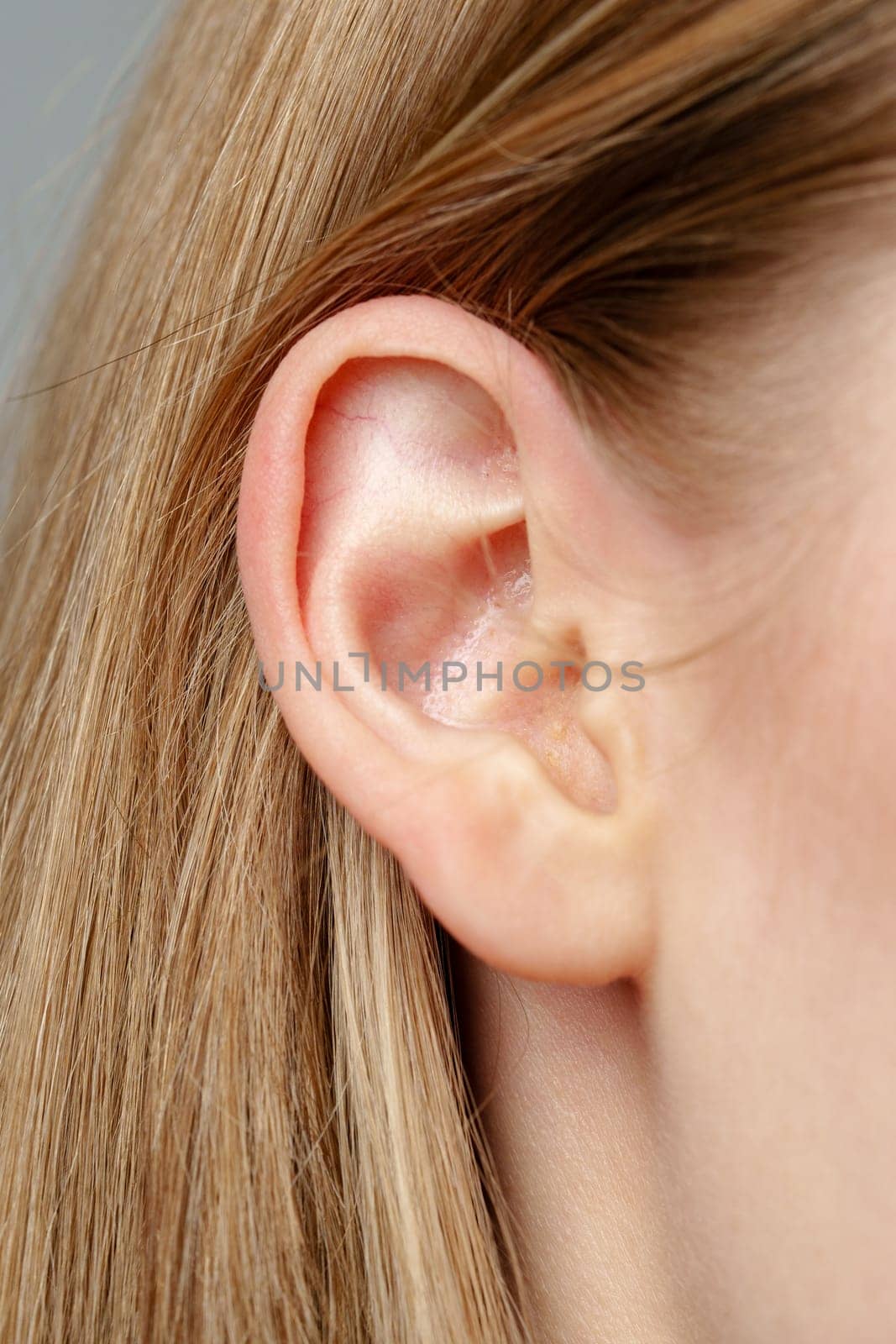 Close Up of Young Blonde Womans Ear by Fabrikasimf
