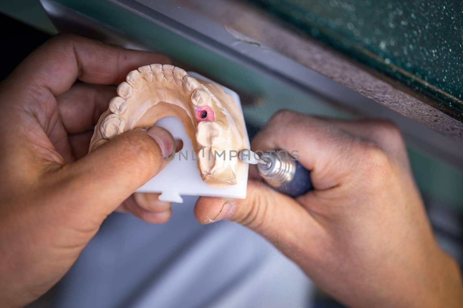 Dental technician's hands make new prosthetics in the lab.