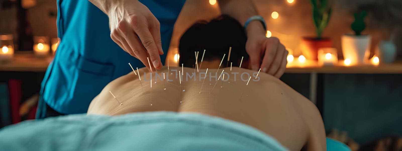 Acupuncture in a spa salon. Selective focus. People.