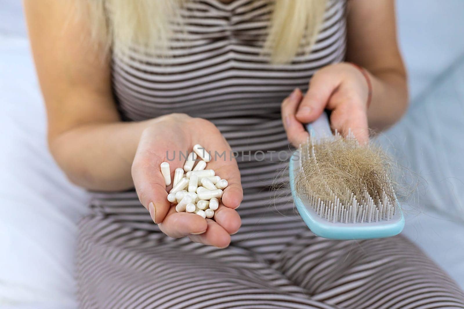 A woman's hair falls out vitamins. Selective focus. People.