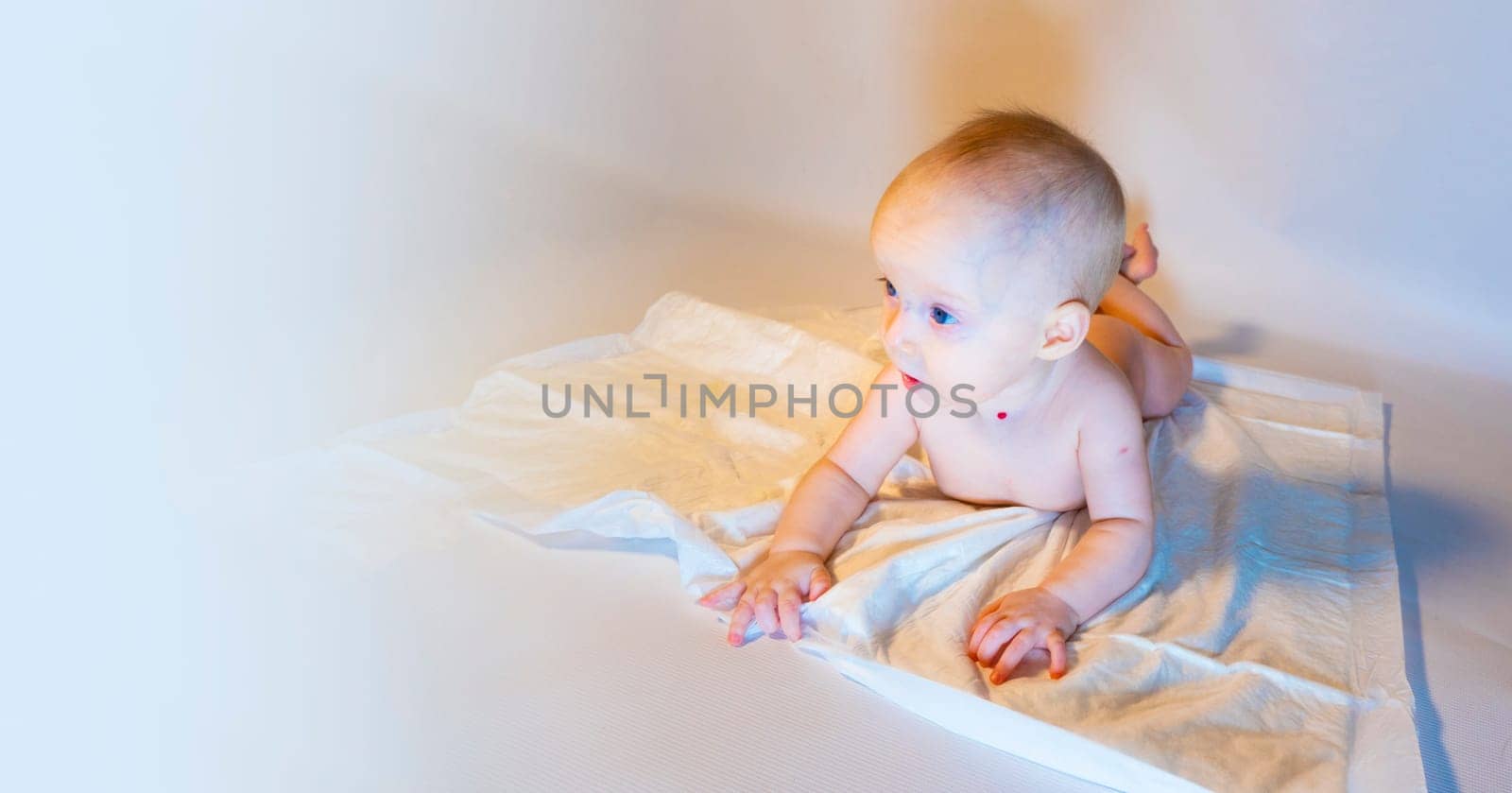 a baby with a hemangioma on his neck lies on a white background. banner with a copy space. a child on a disposable diaper. purity