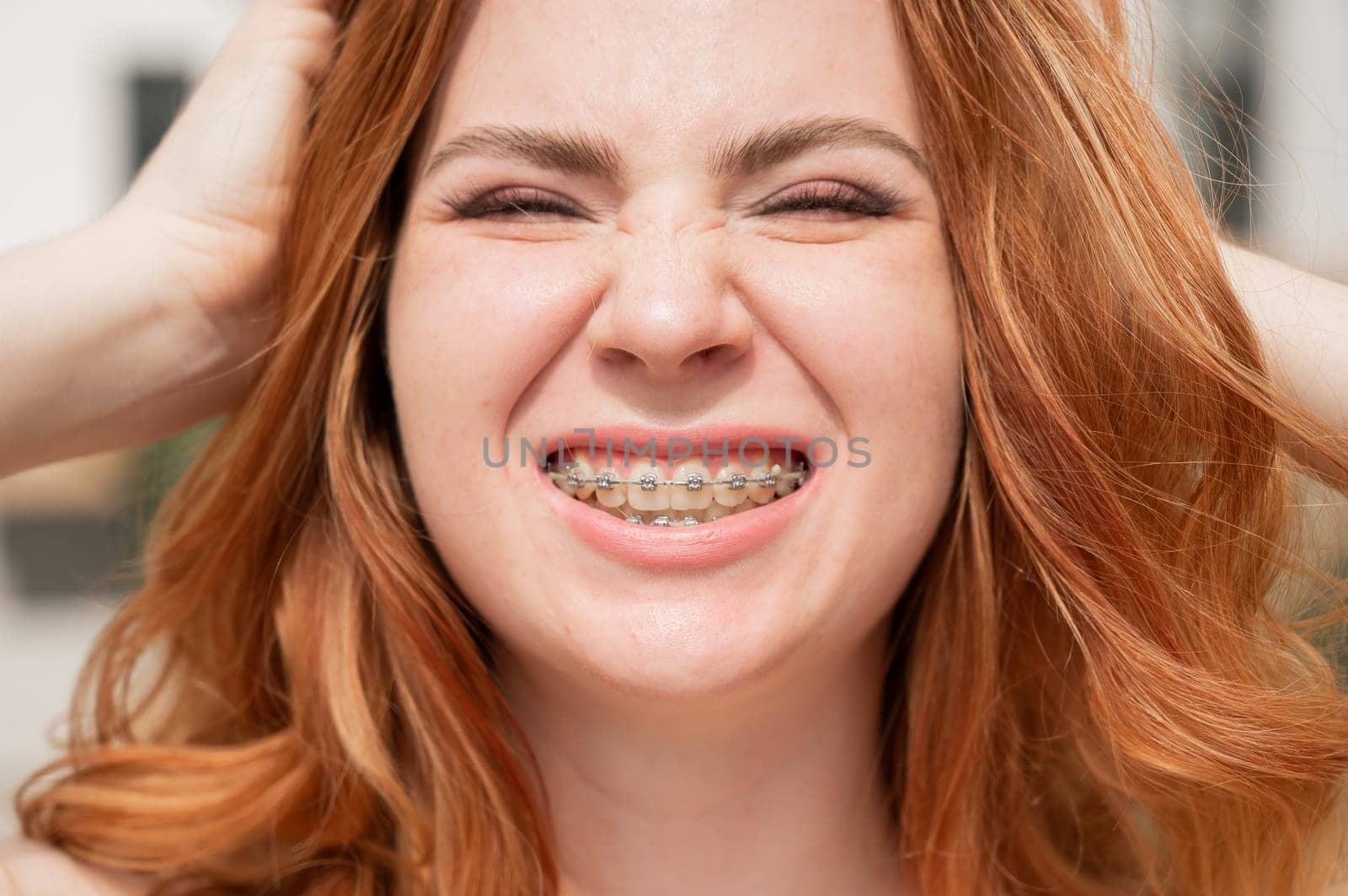 Close-up portrait of a young red-haired woman with braces on her teeth. Girl makes faces at the camera outdoors