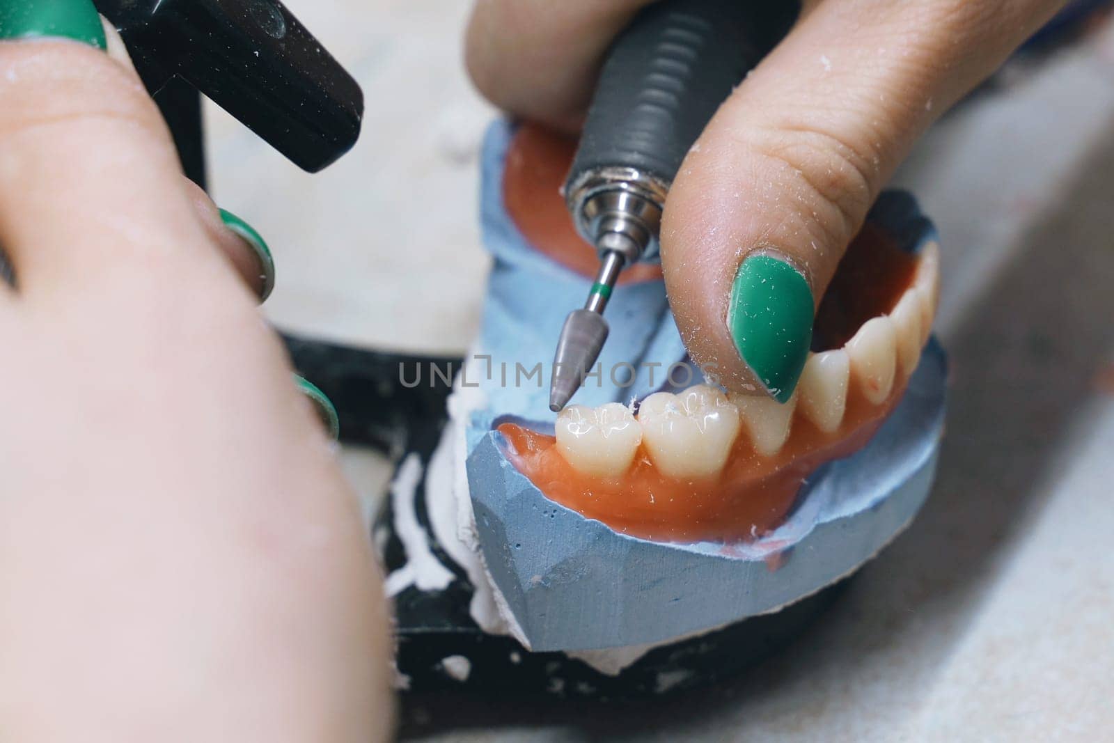 A dental technician cuts and cleans dentures with a milling cutter in a dental laboratory. Close-up